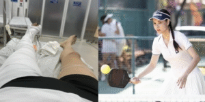 Kỳ Hân Cập Nhật Tình Trạng Sức Khỏe Sau Chấn Thương Nghiêm Trọng Khi Chơi Pickleball