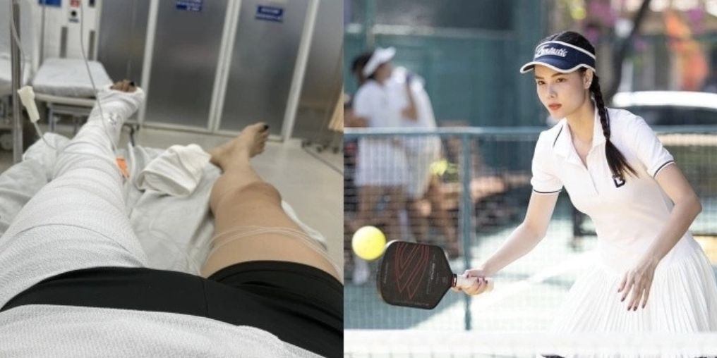 Kỳ Hân Cập Nhật Tình Trạng Sức Khỏe Sau Chấn Thương Nghiêm Trọng Khi Chơi Pickleball